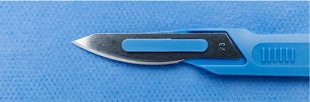 Excisional Biopsy