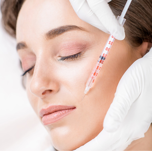Chemical Peels